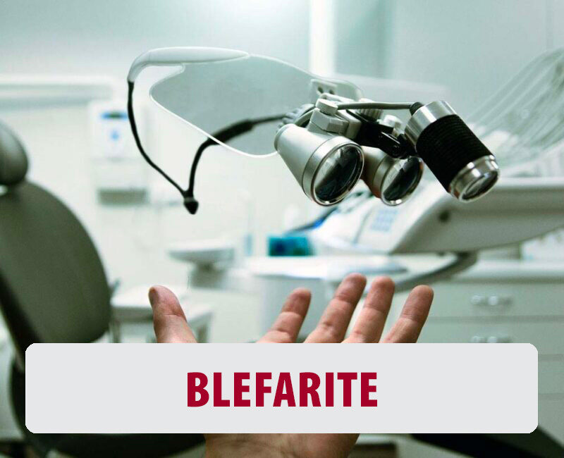 blefarite Torino